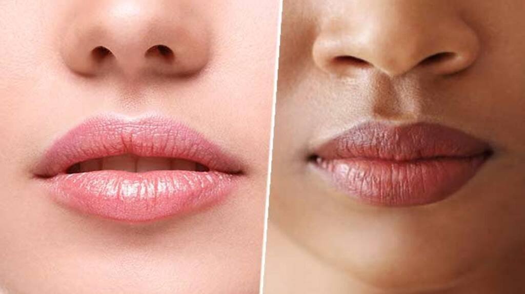 lip pigementation treatment