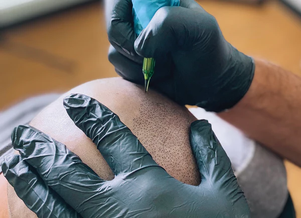 After-Care-Scalp-micropigmentation