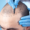 difference-between-scalp-micropigmentation-and-hair-transplants