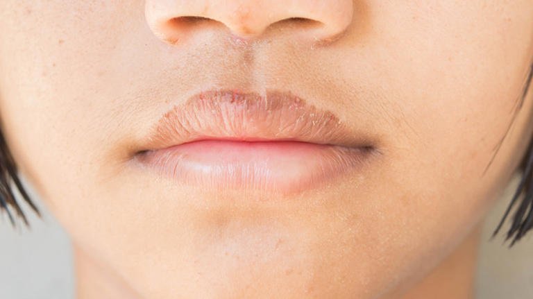Lip-Discoloration