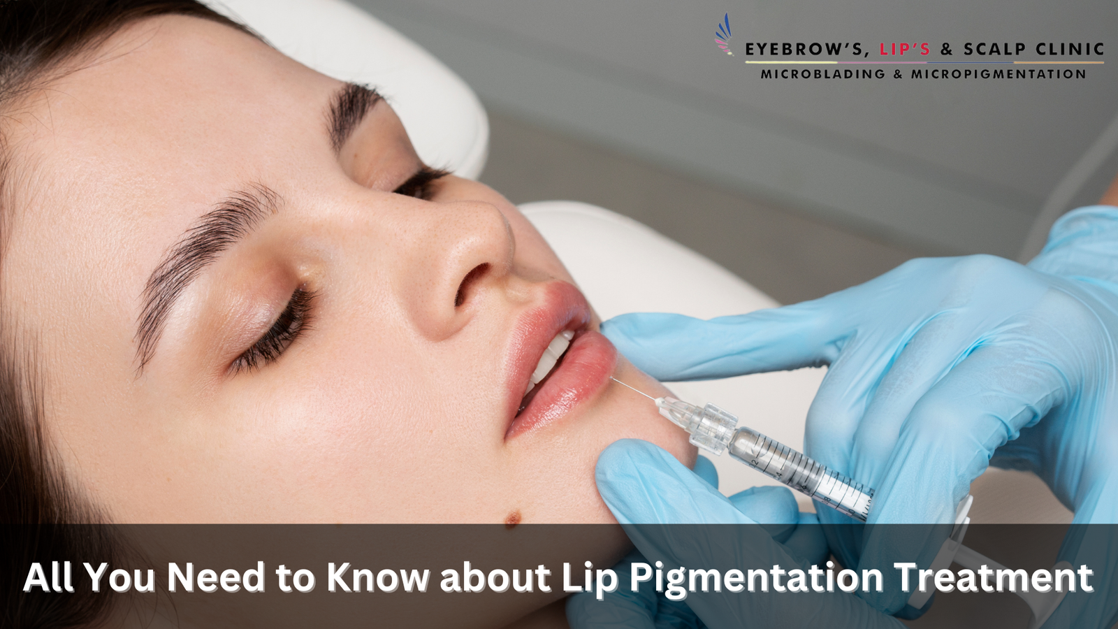 All You Need to Know about Lip Pigmentation Treatment