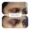 results-eyebrow-lips-and-scalp-clinic-10