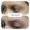 results-eyebrow-lips-and-scalp-clinic-11