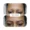 results-eyebrow-lips-and-scalp-clinic-15