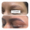 results-eyebrow-lips-and-scalp-clinic-18