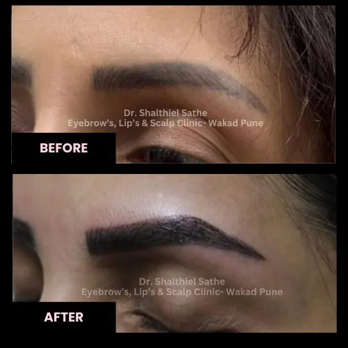 before-after-microblading-1