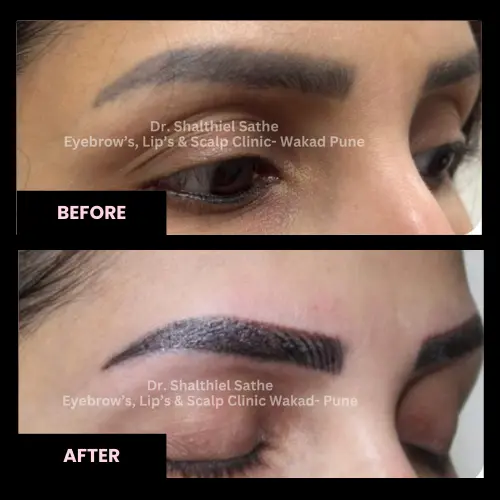 before-after-microblading-2