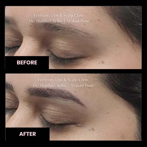 results-eyebrow-microblading-before-after