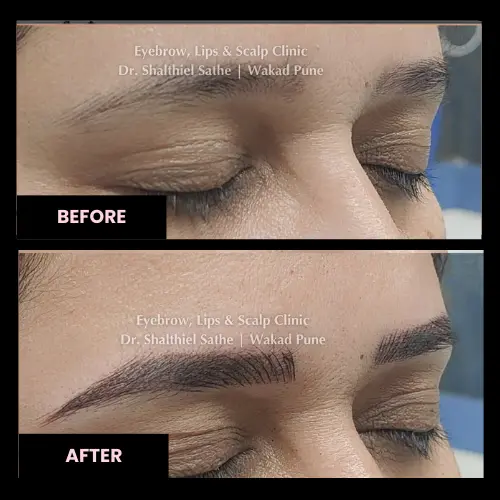 results-eyebrow-microblading-before