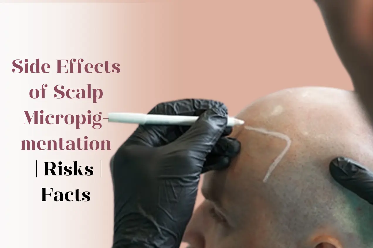 side-effects-of-scalp-micropigmentation