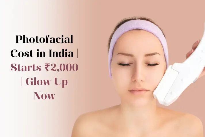 Photofacial-treatment-Cost-in-India