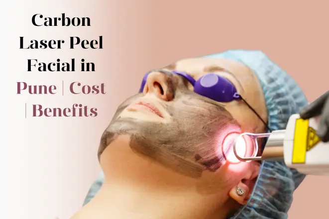carbon-laser-peel-facial-pune