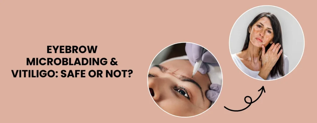 eyebrow-microblading-for-people-with-vitiligo