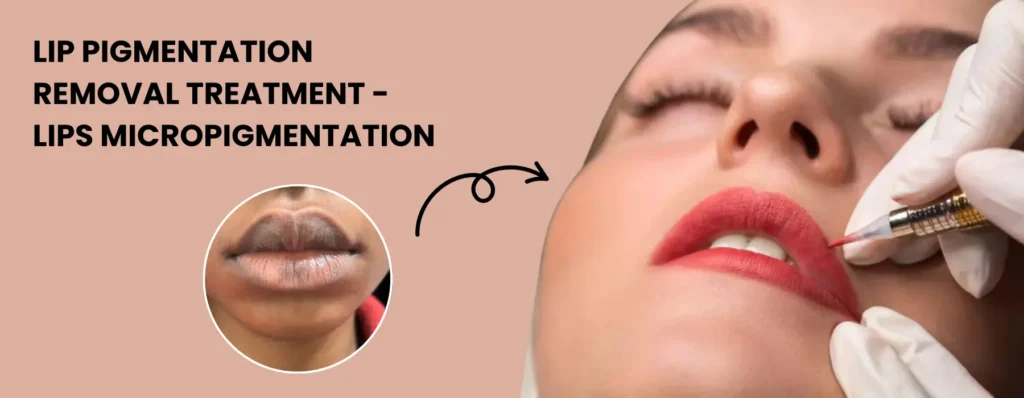 Lip Pigmentation Removal