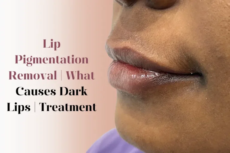 Lip Pigmentation Removal treatment