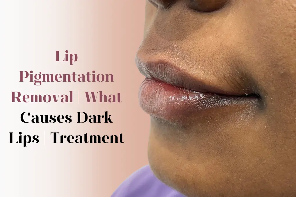 Lip Pigmentation Removal treatment