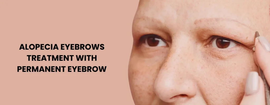 Alopecia Eyebrows