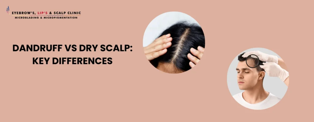 Dandruff vs Dry Scalp