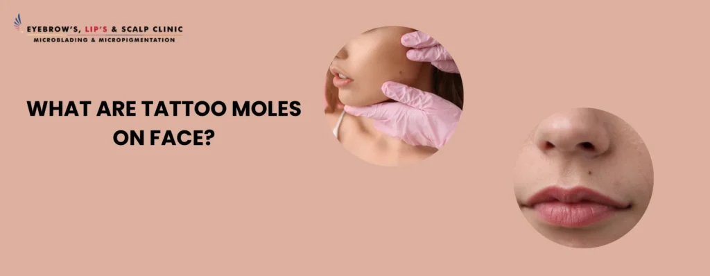 Tattoo Moles on Face
