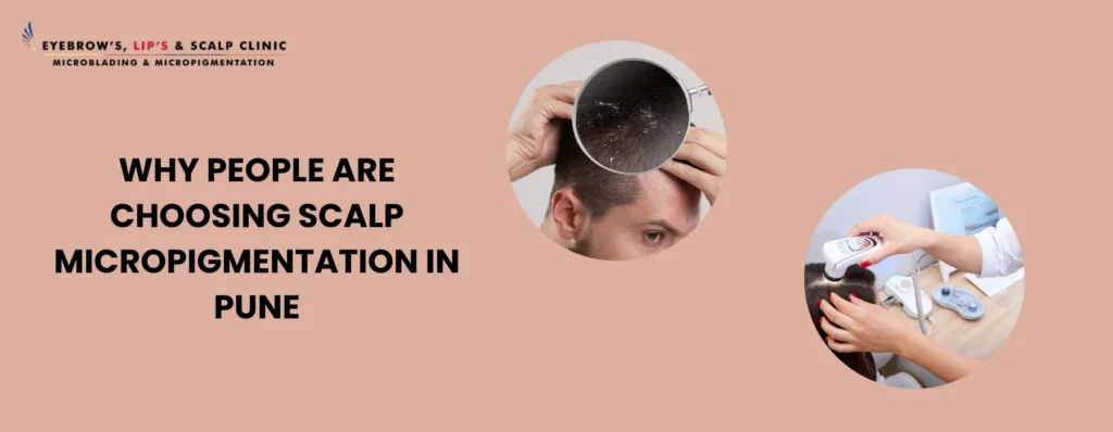 Scalp Micropigmentation Side Effects