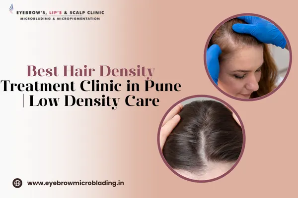 Hair Density Treatment