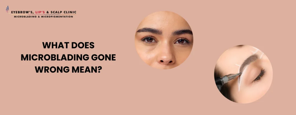 Microblading Gone Wrong