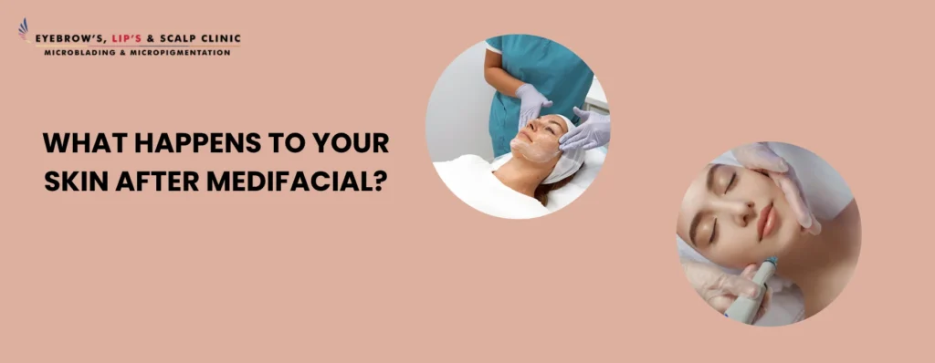 MediFacial in Pune