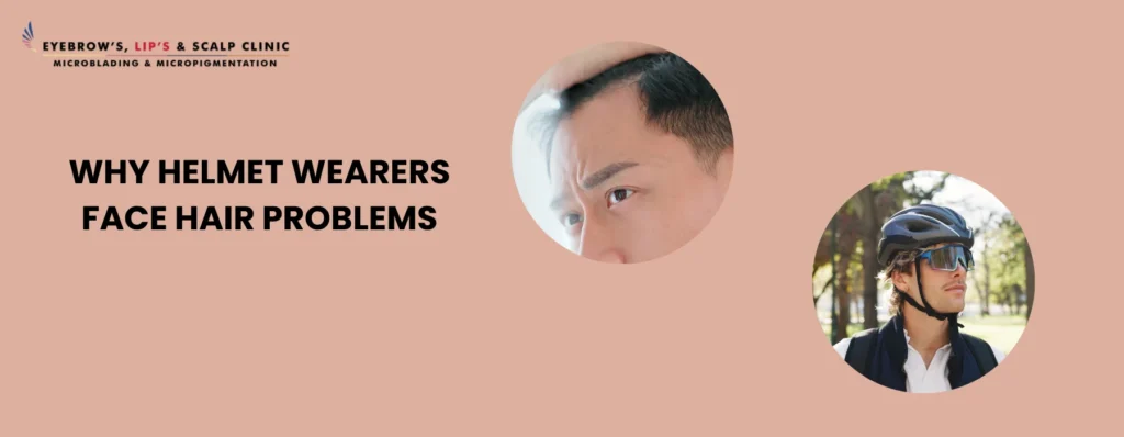 SMP for Helmet Wearers