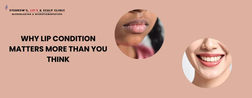 Dry Lips vs Soft Lips