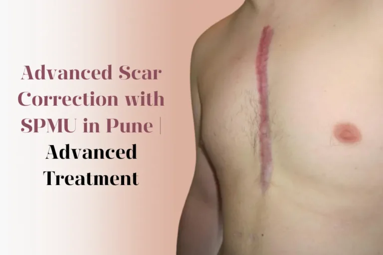 Advanced Scar Camouflage using SMPU