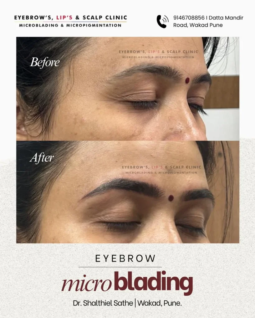 Eyebrows Microblading photos