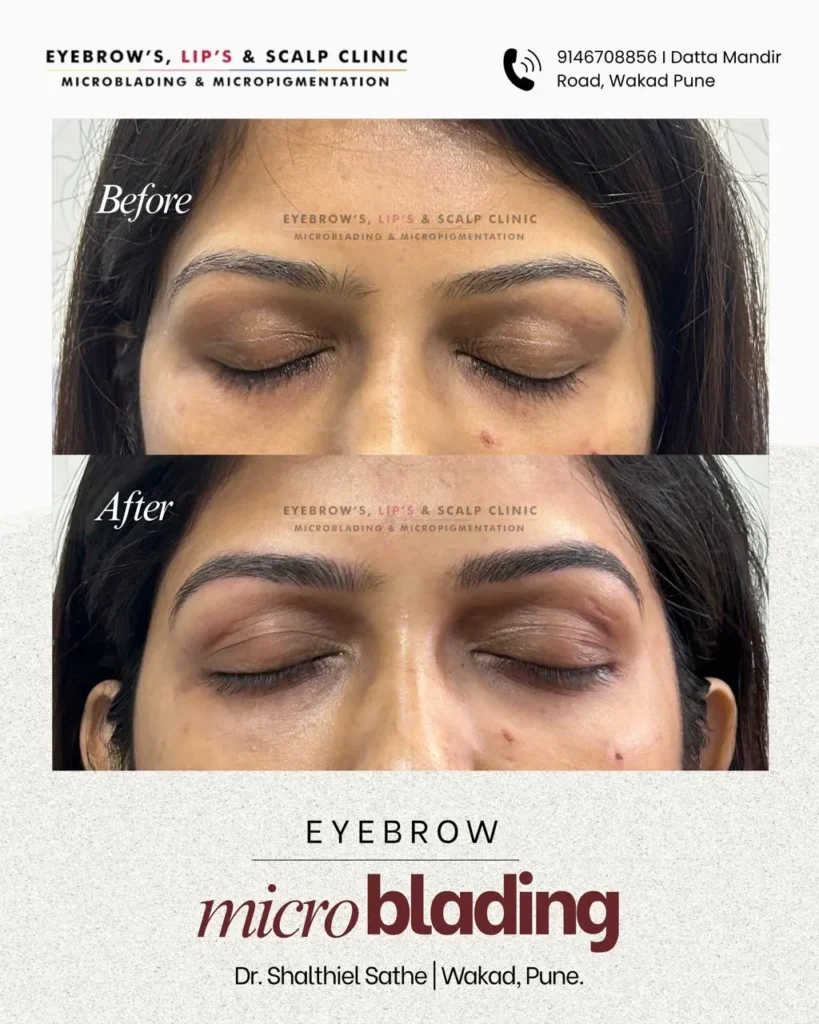 Permanent Eyebrows before after