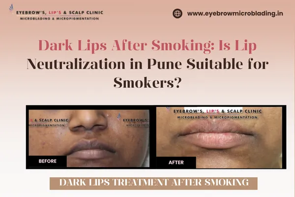 dark lips treatment in pue for oily skin