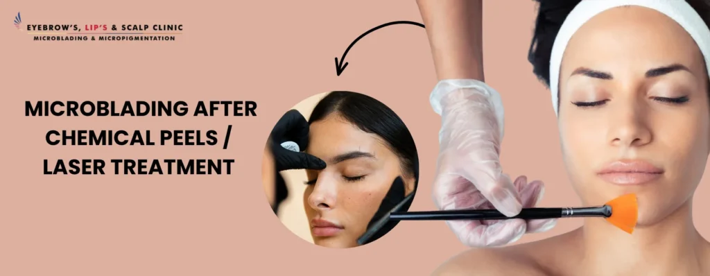 microblading-after-chemical-peels