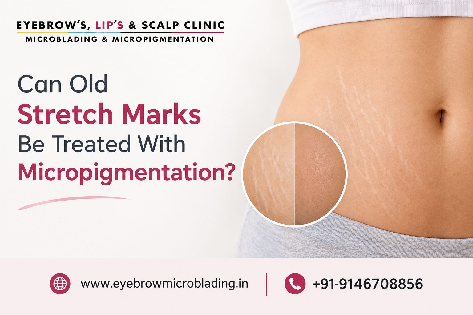 Micropigmentation Stretch